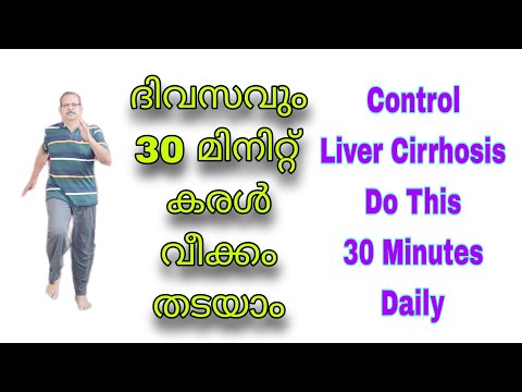 കരൾ വീക്കം നിയന്ത്രിക്കാൻ 30 മിനിറ്റ് വ്യായാമം||30 Minutes Exercise to Control Liver Cirrhosis