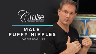 How to treat male puffy nipples - gynecomastia