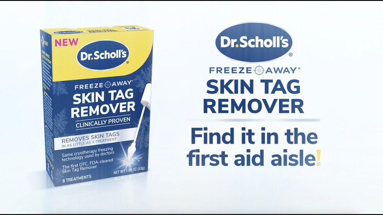 1 Month After  Dr. Scholl's Freeze Away Skin TAG Remover 