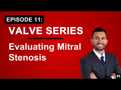 11. How to Evaluate Mitral Stenosis (MS) - TEE for Mitral Valve Surgery (Echocardiography)
