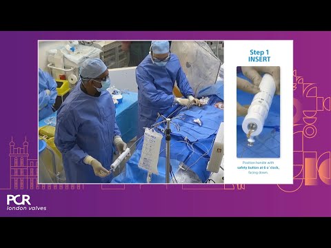 TAVI unleashed: optimisation of immediate and long-term outcomes  - PCR London Valves 2023