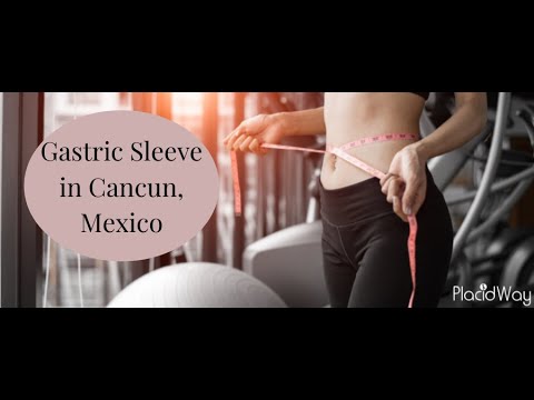 Watch Gastric Sleeve in Cancun, Mexico