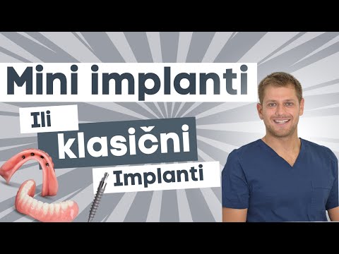 Mini implanti ili Klasični implanti?