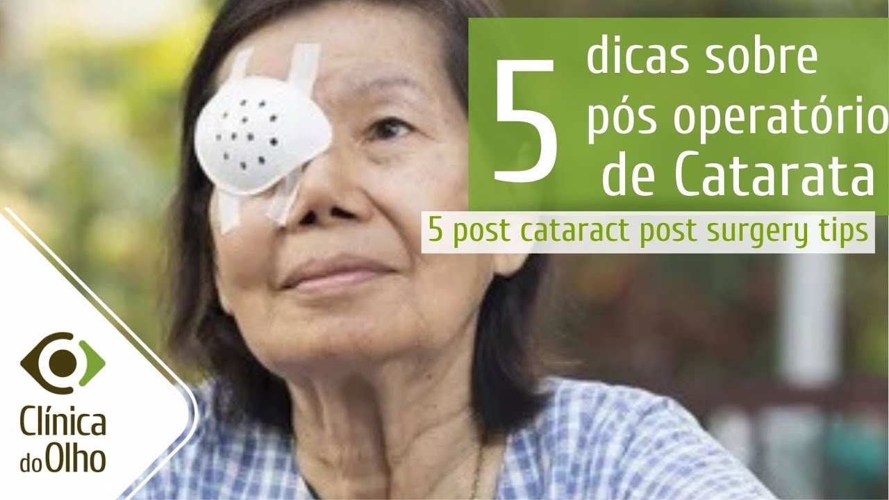 5 tips post cataract surgery