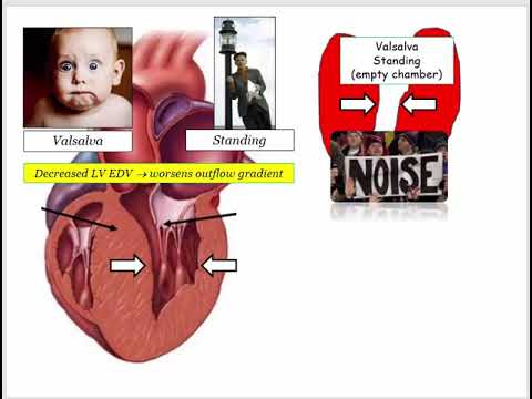 12DaysinMarch, Valvular Heart Disease #8, HCM and Questions for the USMLE Step One Exam