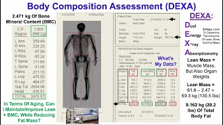 Body Composition Assessment (DEXA), 12/2022