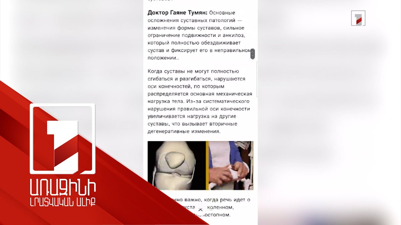 Դեղերի կեղծ գովազդ՝ համացանցում. մասնագետների խորհուրդը