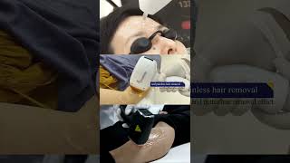 3 tips for using this diode laser hair removal machine