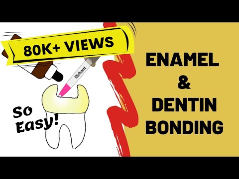 Enamel and Dentin Bonding Simplified
