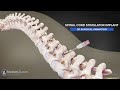 3D Surgery Animation of Spine Injury Portrays Spinal Cord Stimulator Implant