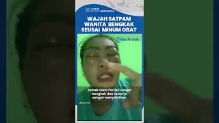 Viral Curhatan Satpam Wanita Wajahnya Membengkak Seusai Minum Obat Sakit Kepala, Ini Kata Dokter