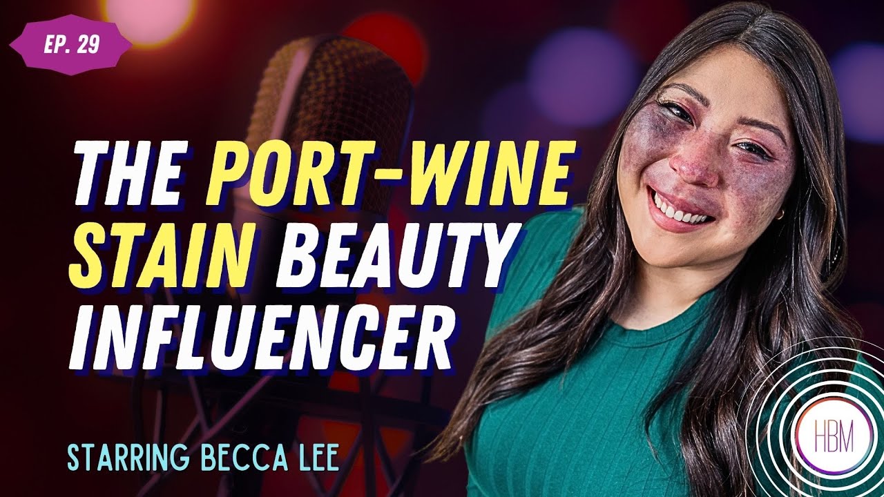 Episode 29: Becca Lee - How Revealing My Port-Wine Stain Changed My Life