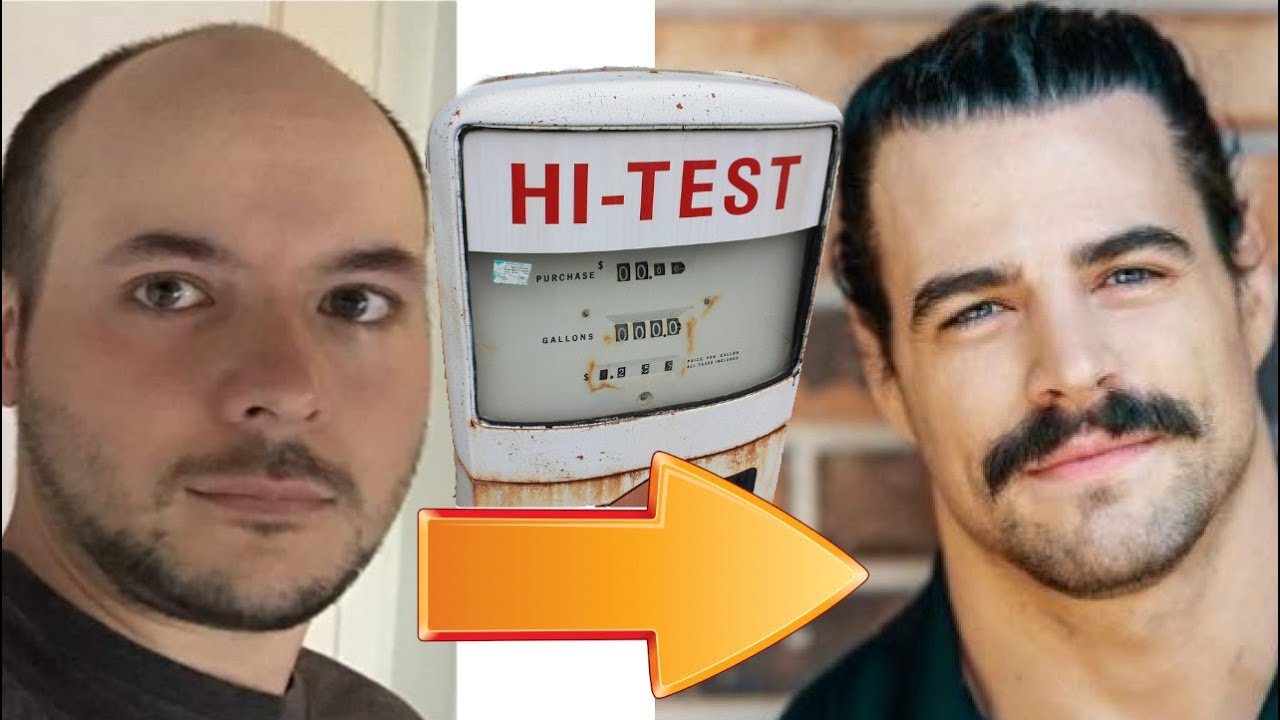 Why testosterone does NOT cause hair loss