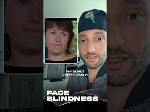 Imagine not recognizing your reflection. #prosopagnosia #faceblindness #psychology #medical #doctor