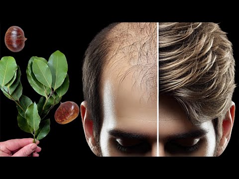 Bald at 45 – Full Hair in Weeks? Bay Leaf & Chestnuts Elixirs Finally Revealed