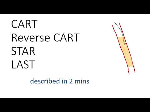 The acronyms CART, reverse CART, STAR & LAST described in 2 minutes.