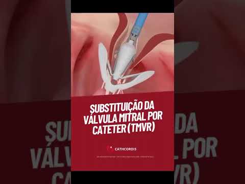 Hedilberto Feitosa-23