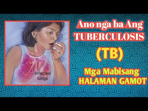 Ano ang sakit na tuberculosis (TB) | Mga Mabisang Halaman gamot Para sa TB