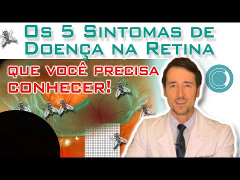 Principais sintomas de doença na retina.