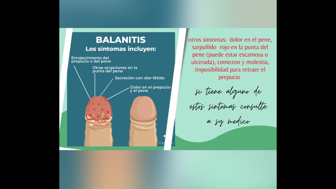 Watch Balanitis Now Balanitis
