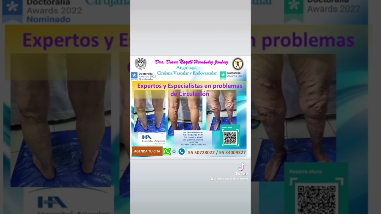 Diana Nayeli Hernández Jiménez-76