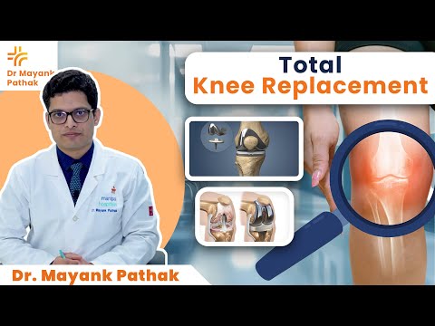 Total Knee Replacement | Dr. Mayank Pathak