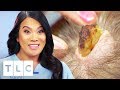 Removing A Horn-Like Growth And 6 Cysts From Woman's Head | Dr. Pimple Popper