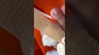 S18 How to treat a wound 👣วิธีการทำแผล หลังตัดเล็บขบ 😄 (clip from Thailand)