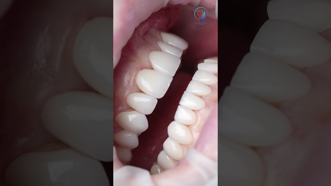 Video 2