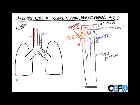 How to use a Double Lumen Endotracheal Tube
