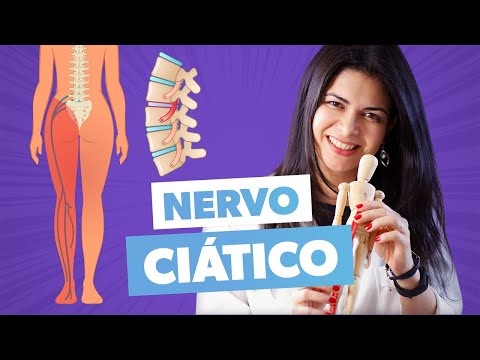 Imagem ilustrativa do vídeo: EXERCÍCIOS PARA CURAR NERVO CIÁTICO INFLAMADO