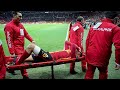 Worst stretcher carriers in the world, fails, falls, injuries