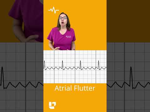 Difference between atrial fibrillation and atrial flutter F