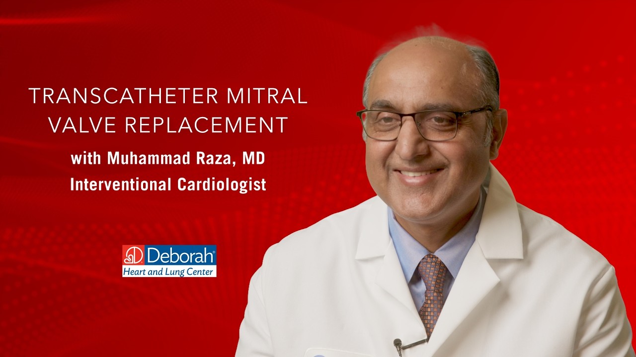 Transcatheter Mitral Valve Replacement