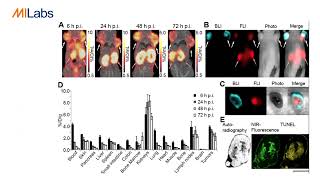 Improved Multimodal Tumor Necrosis Imaging