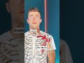 Thoracic Outlet Syndrome TOS AKA Tingly Hands