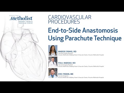 End-to-Side Anastomosis using Parachute Technique (Drs. Madeline Drake, Paul Haddad, Eric Peden)