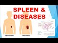 USMLE Step 1 Immunology SPLEEN & DISEASES with 20 USMLE Step 1 questions.