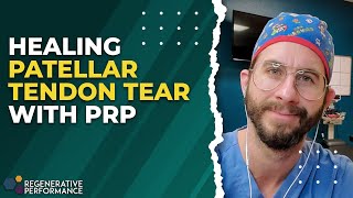 Healing Patellar Tendon Tear with PRP