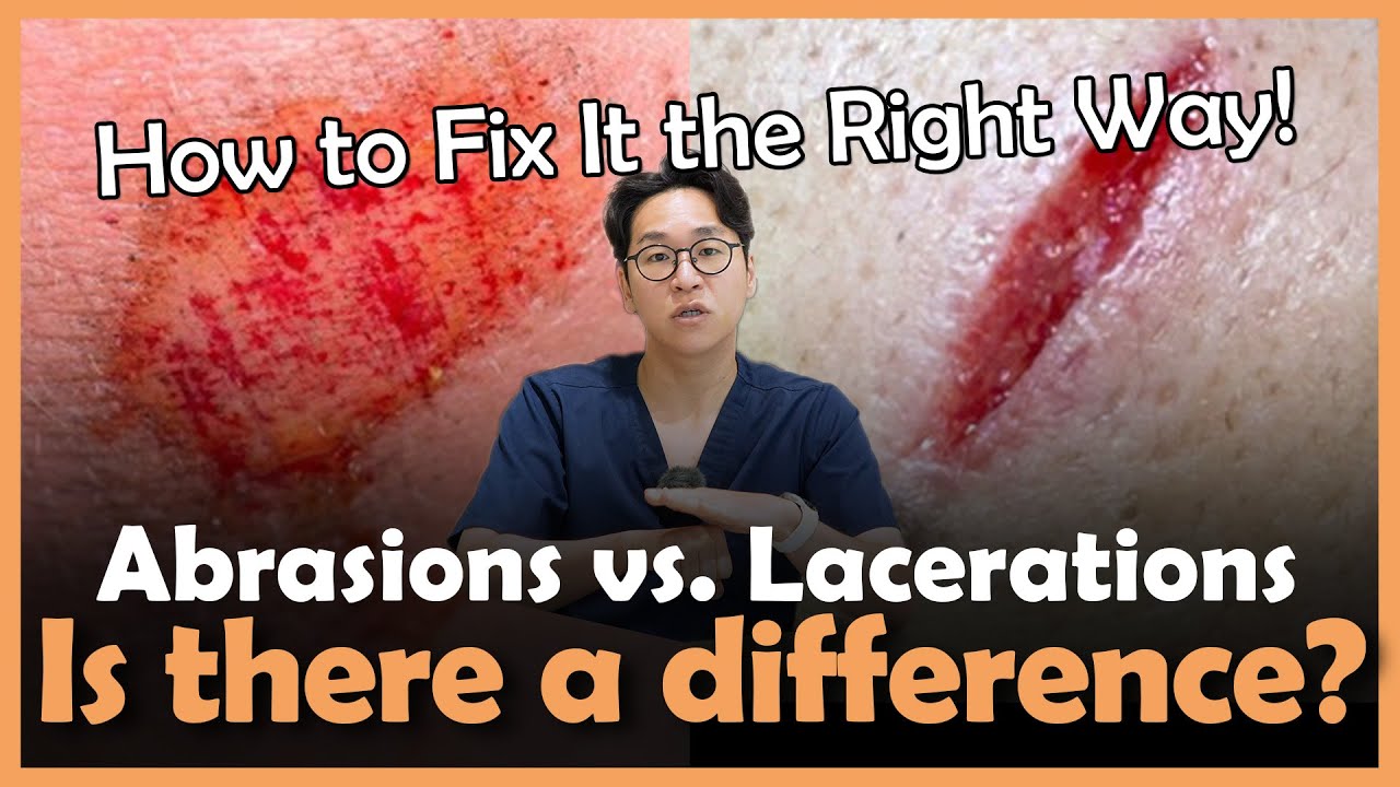 Nose reshaping technique