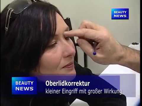 Was ist Ekzem bdu Auf welchen Körperteilen die Schuppenflechte gezeigt wird