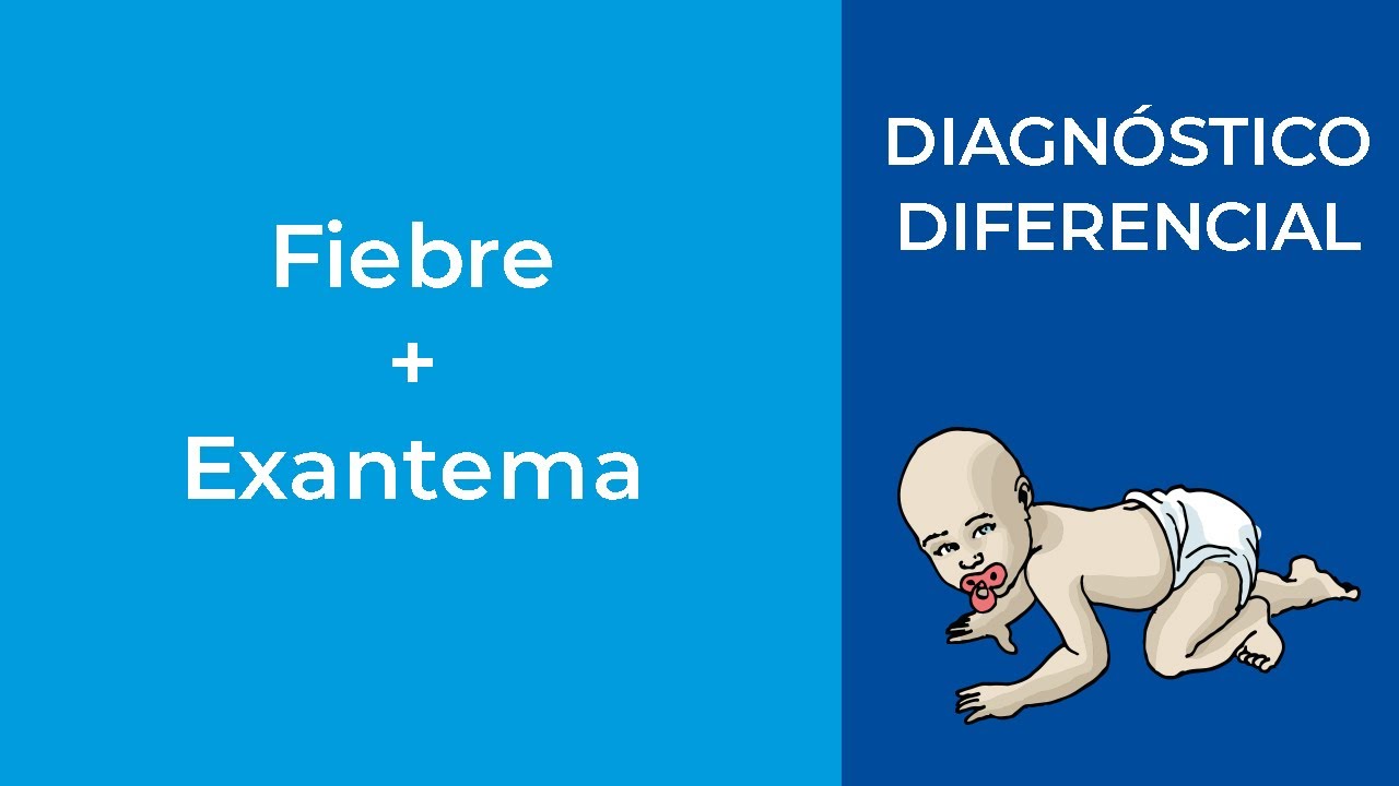 Diagnóstico Diferencial. Fiebre+Exantema