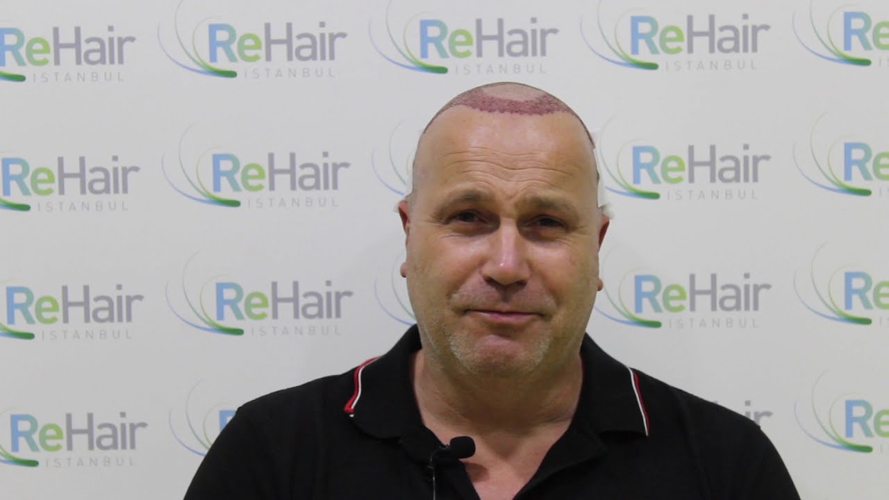 ReHair Istanbul Review - Haartransplantatie in Turkije, Istanbul