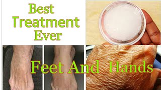Treat Dry And Wrinkled Hands And Feet With This Simple And Easy DIY Gel