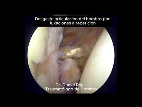 Daniel Rojas Castillo-40