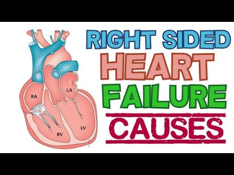*important* THE MAIN CAUSES OF RIGHT SIDED HEART FAILURE