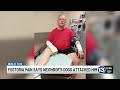 Fostoria Man Recovering After Dog Attack Chihuahua Killed
