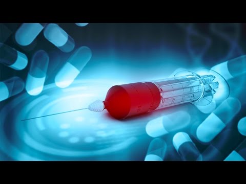 Haarausfall mit Typ-2-Diabetes-Behandlung Zahnimplantat für Diabetiker