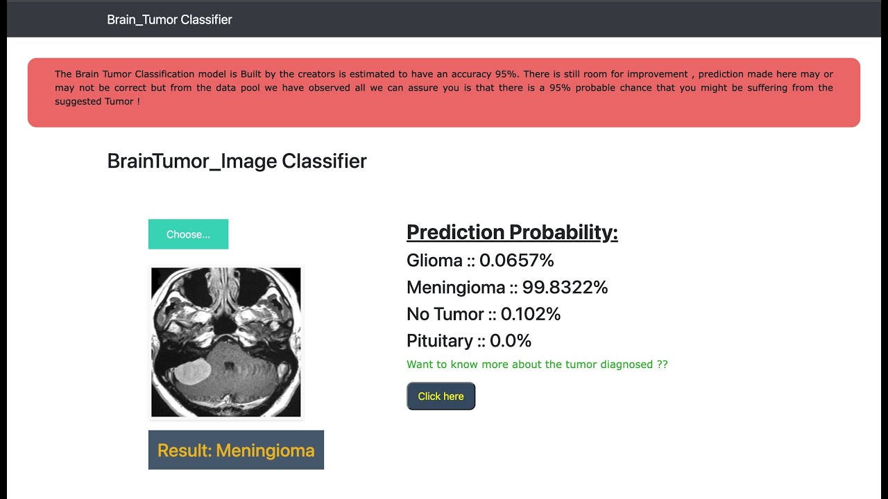 Multi Class Brain Tumor Classification - SmartInternz