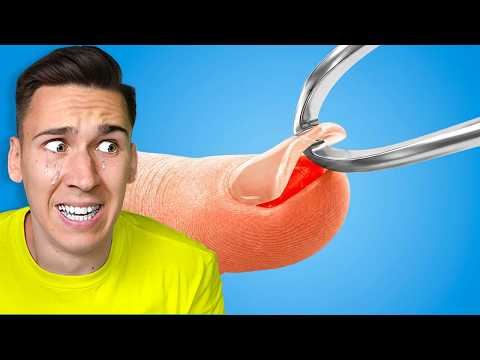 OVAJ VIDEO ĆE VAS ZABOLETI!